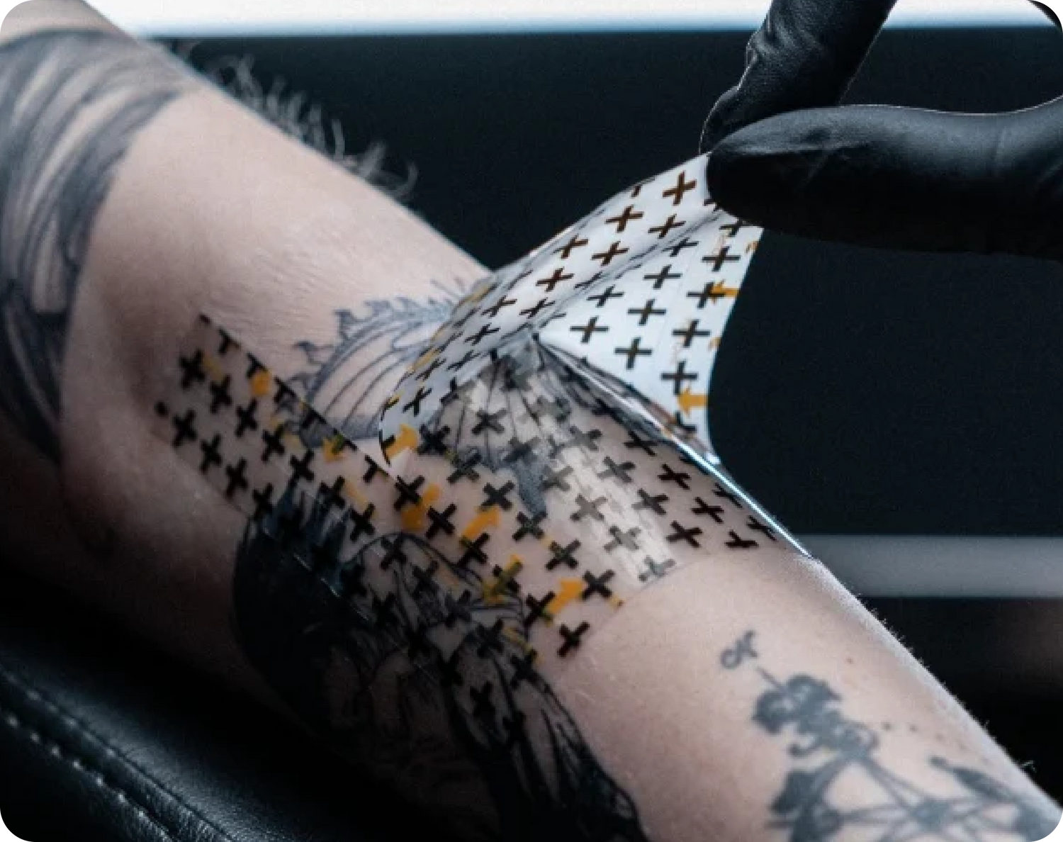 The first Derm Shield application should stay in place for 24 hours, depending on level of exudation. It is normal for blood and fluids to collect under the bandage. A second application can be used for several days, and a third application may be used if necessary.