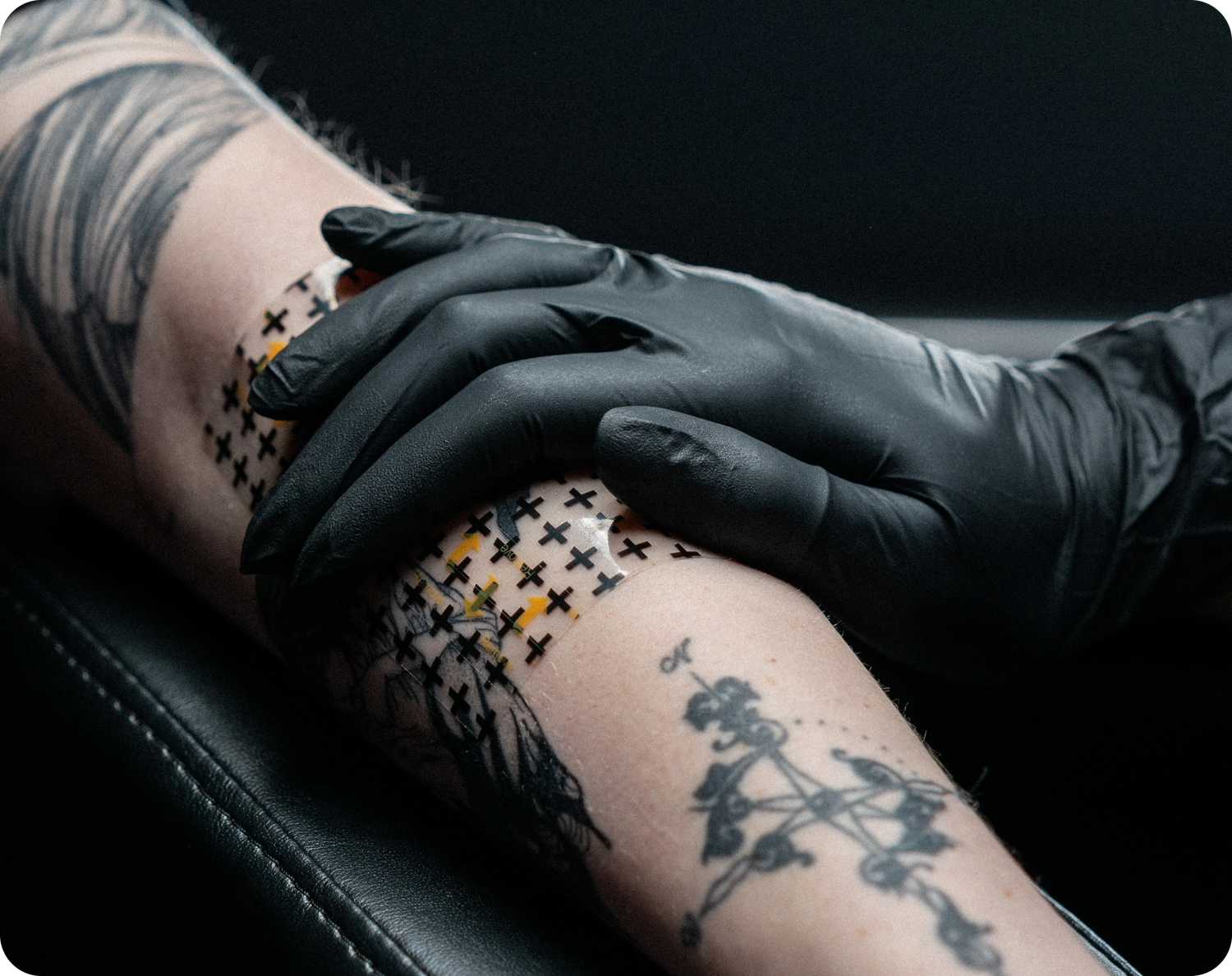 Gently apply using light pressure, starting from the center to the edges to eliminate air bubbles. Do not stretch the Derm Shield during application.