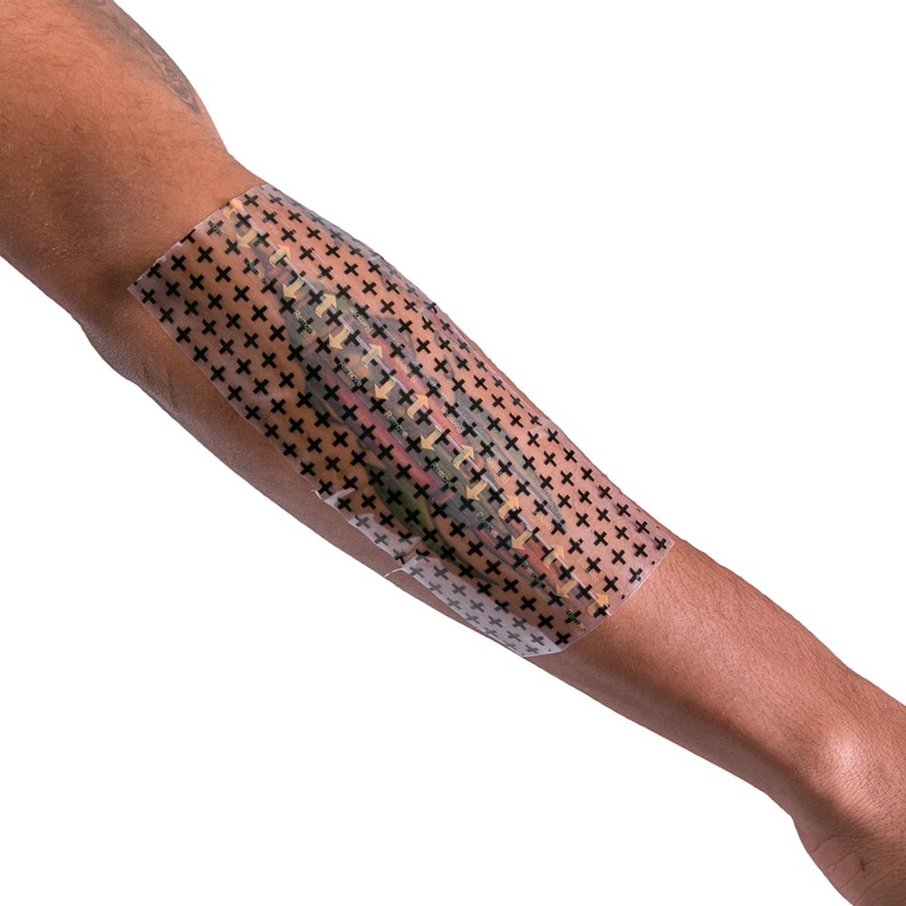 Recovery Derm Shield Example 3